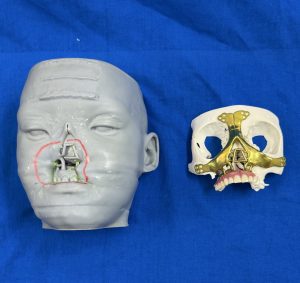 Illustration of the face and the face reconstruction.